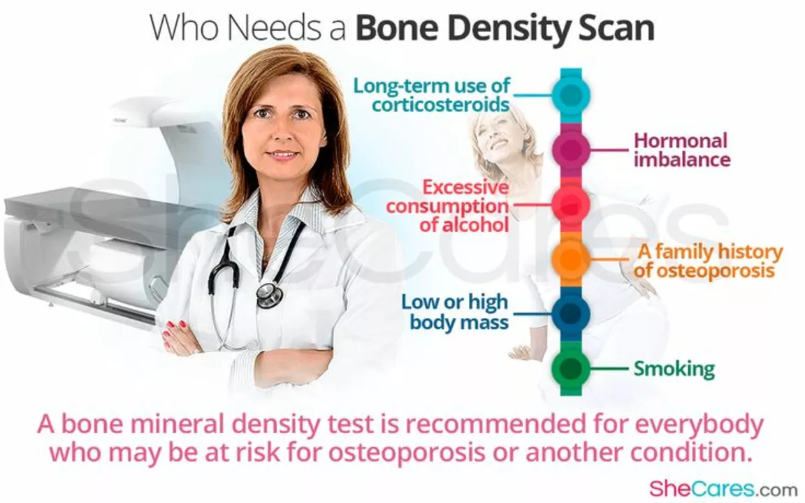 Alendronate: A Miracle Drug for Osteoporosis Management