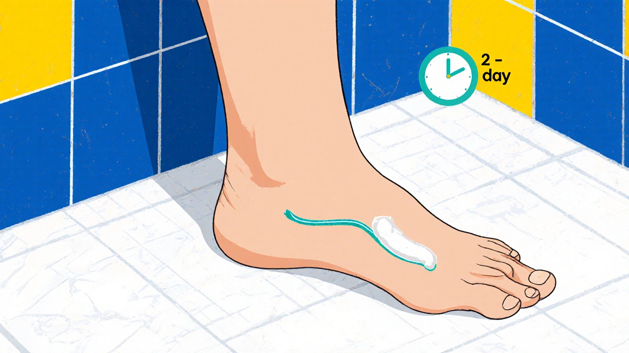 Illustration of a foot being treated with a thin layer of fenticonazole cream.